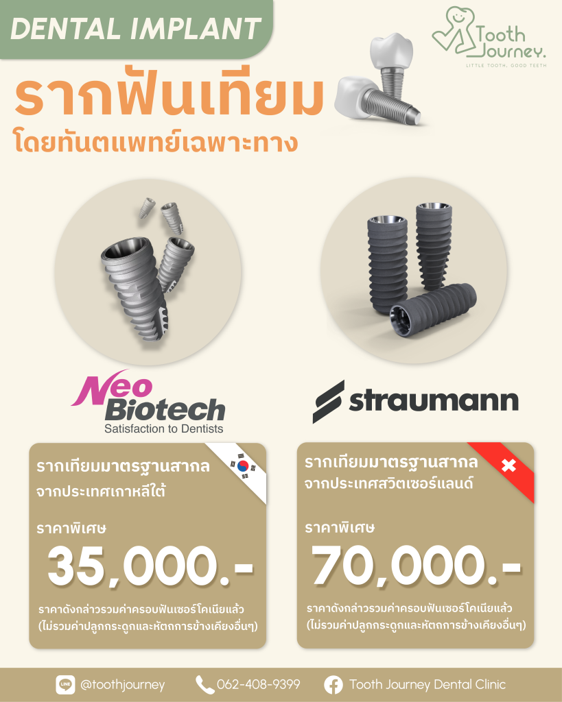 Dental Implant_Final