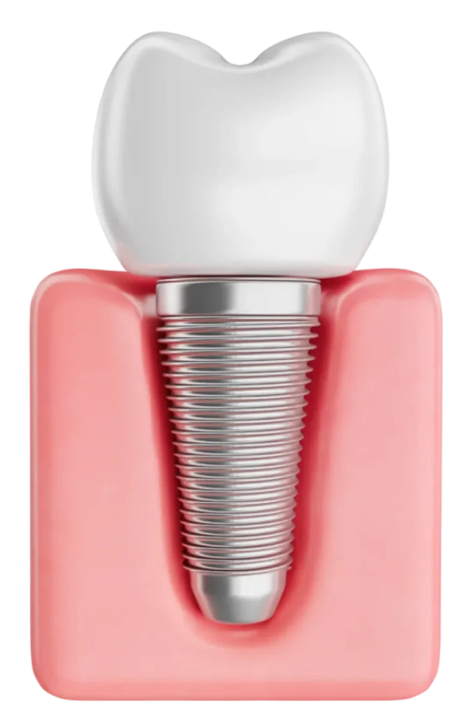 teeth_with_gingiva_69-Photoroom 1